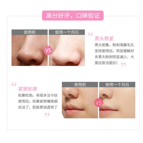 男士专用洗脸仪电动硅胶洁面刷充电去黑头洁面神器深层毛孔清洁器